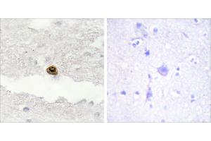 Peptide - +Immunohistochemistry analysis of paraffin-embedded human brain tissue, using DGKZ antibody. (DGKZ antibody)