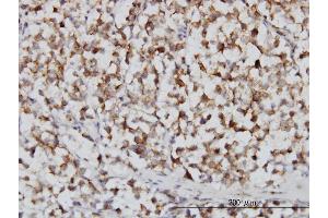 Immunoperoxidase of monoclonal antibody to FH on formalin-fixed paraffin-embedded human seminoma. (FH antibody  (AA 33-510))