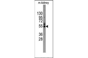 Image no. 1 for anti-Matrix Metallopeptidase 12 (Macrophage Elastase) (MMP12) (C-Term) antibody (ABIN358685) (MMP12 antibody  (C-Term))