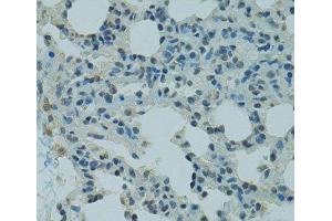 Immunohistochemistry of paraffin-embedded Rat lung using PRDM2 Polyclonal Antibody at dilution of 1:100 (40x lens). (PRDM2 antibody)