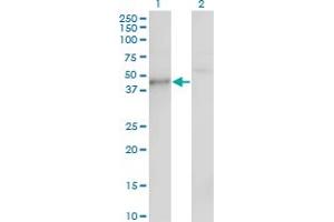 Western Blot analysis of CSNK1G1 expression in transfected 293T cell line by CSNK1G1 monoclonal antibody (M01), clone 3D1. (CSNK1G1 antibody  (AA 293-393))