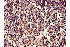 Immunohistochemistry of paraffin-embedded human spleen tissue using ABIN7157042 at dilution of 1:100 (IRF3 antibody  (AA 1-452))