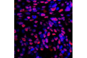 Immunofluorescence (IF) image for anti-Replication Protein A2, 32kDa (RPA2) (C-Term) antibody (ABIN7449012) (RPA2 antibody  (C-Term))
