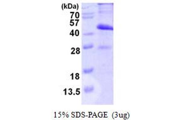 MAD2L1BP Protein (AA 1-274) (His tag)
