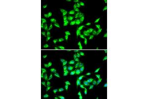 Immunofluorescence analysis of HeLa cells using ANTXR1 antibody (ABIN5973910).