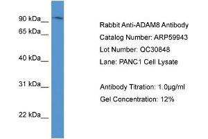 WB Suggested Anti-ADAM8  Antibody Titration: 0. (ADAM8 antibody  (N-Term))