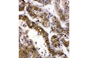IHC analysis of ADH5 using anti-ADH5 antibody (ABIN4886429). (ADH5 antibody  (AA 212-374))