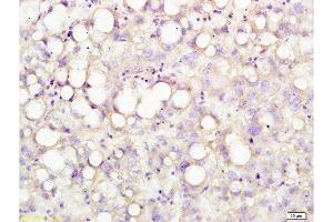 Formalin-fixed and human liver tissue labeled with Anti-USP-1 Polyclonal Antibody, Unconjugated  at 1:200 followed by conjugation to the secondary antibody and DAB staining (USP1 antibody  (AA 701-785))