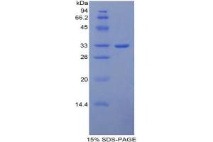 SDS-PAGE analysis of Mouse ITIH1 Protein. (ITIH1 Protein)