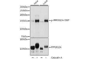 Western blot analysis of extracts of various cell lines, using Phospho-PPP1R12A-S507 antibody (ABIN6135287, ABIN6136196, ABIN6136197 and ABIN6225664) at 1:2000 dilution or PPP1R12A antibody (ABIN6128260, ABIN6146059, ABIN6146061 and ABIN6213896). (PPP1R12A antibody  (pSer507))