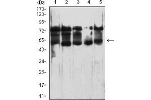 Western Blotting (WB) image for anti-Peptidase Inhibitor 16 (PI16) (AA 79-210) antibody (ABIN7193462)