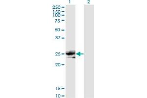 Western Blot analysis of NOG expression in transfected 293T cell line by NOG monoclonal antibody (M11), clone 2C10. (NOG antibody  (AA 27-145))