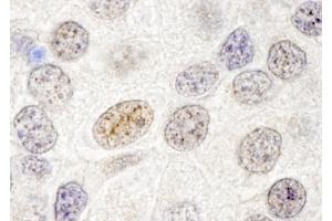 Immunohistochemistry (IHC) image for anti-GATA Zinc Finger Domain Containing 2B (GATAD2B) (AA 50-100) antibody (ABIN7448709) (GATAD2B antibody  (AA 50-100))