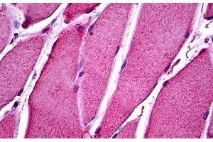 Human Skeletal Muscle: Formalin-Fixed, Paraffin-Embedded (FFPE) (ATP11B antibody  (N-Term))