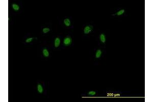 Image no. 1 for anti-CSE1 Chromosome Segregation 1-Like (CSE1L) (AA 872-972) antibody (ABIN465991) (Exportin 2 antibody  (AA 872-972))