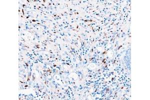 IHC analysis of CD68 using anti-CD68 antibody (ABIN7600142). (CD68 antibody  (AA 154-354))