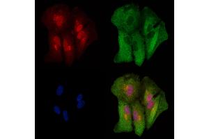 ABIN6262790 and ABIN6278915 staining  cells by IF/ICC. (KRT9 antibody  (Internal Region))
