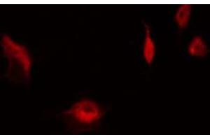 ABIN6267563 staining HeLa by IF/ICC. (RPS6 antibody  (pSer235))