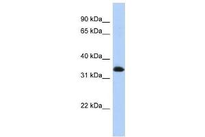 ZNF511 antibody used at 0. (ZNF511 antibody  (N-Term))