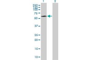 Western Blot analysis of STIP1 expression in transfected 293T cell line by STIP1 MaxPab polyclonal antibody. (STIP1 antibody  (AA 1-543))
