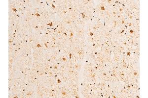 ABIN6267232 at 1/100 staining human heart tissue sections by IHC-P. (Tumor Protein p73 antibody  (pTyr99))