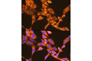 Immunofluorescence analysis of NIH-3T3 cells using F/UBD Rabbit mAb (ABIN7271134) at dilution of 1:100 (40x lens). (UBD antibody)