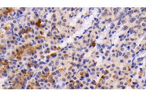 Detection of CASP3 in Rat Stomach Tissue using Polyclonal Antibody to Caspase 3 (CASP3) (Caspase 3 antibody  (AA 183-277))