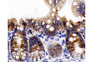 Immunohistochemistry analysis of paraffin-embedded rat colon using E-Cadherin Monoclonal Antibody at dilution of 1:300. (E-cadherin antibody)