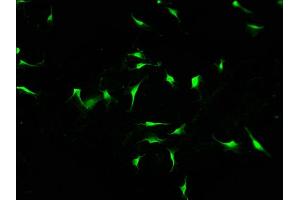 Immunofluorescence staining of U251 cells with ABIN7156399 at 1:100, counter-stained with DAPI. (INTS1 antibody  (AA 51-342))