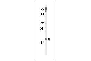CDKN2D antibody  (N-Term)