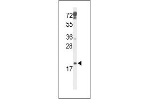 CDKN2D antibody  (N-Term)