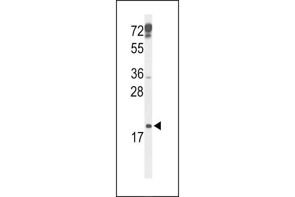 CDKN2D antibody  (N-Term)