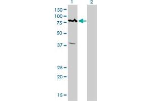 Western Blotting (WB) image for anti-Calcium Responsive Transcription Factor (CARF) (AA 621-718) antibody (ABIN566385)