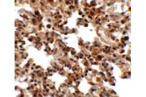 Immunohistochemistry of FXYD7 in rat lung tissue with FXYD7 antibody at 2.