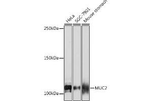 Western blot analysis of extracts of various cell lines, using MUC2 Rabbit mAb (ABIN7268689) at 1:1000 dilution.