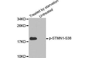 Western blot analysis of extracts from K562 cells, using Phospho-STMN1-S38 antibody. (Stathmin 1 antibody  (pSer38))