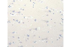 Immunohistochemistry (IHC) image for anti-Solute Carrier Family 18 (Vesicular Monoamine Transporter), Member 2 (SLC18A2) antibody (ABIN1874806) (SLC18A2 antibody)
