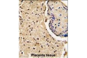 Formalin-fixed and paraffin-embedded human placenta tissue reacted with HtrA3 antibody (N-term), which was peroxidase-conjugated to the secondary antibody, followed by DAB staining. (HTRA3 antibody  (N-Term))