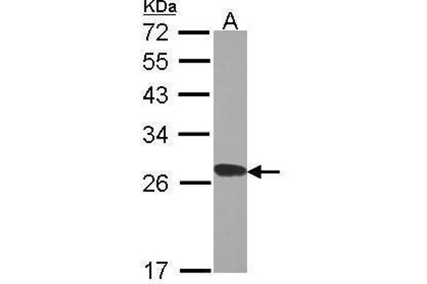 RPL15 anticorps
