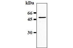 Western Blotting (WB) image for anti-Glial Fibrillary Acidic Protein (GFAP) antibody (ABIN1449150)