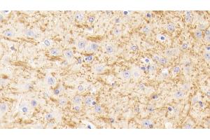 Detection of TUBb1 in Mouse Cerebrum Tissue using Polyclonal Antibody to Tubulin Beta 1 (TUBb1) (TUBB1 antibody  (AA 182-437))