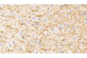 Detection of TUBb1 in Mouse Cerebrum Tissue using Polyclonal Antibody to Tubulin Beta 1 (TUBb1) (TUBB1 antibody  (AA 182-437))