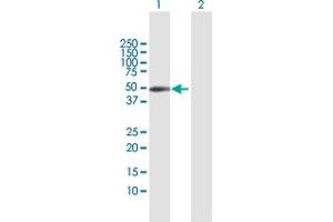 Coxsackie Adenovirus Receptor antibody  (AA 1-365)