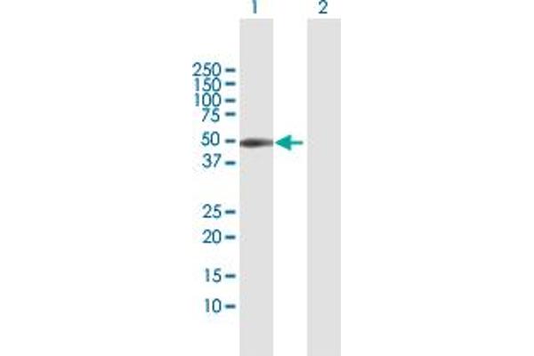 Coxsackie Adenovirus Receptor antibody  (AA 1-365)