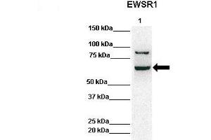 Lanes:   Lane 1: 50ug Hela Lysate  Primary Antibody Dilution:   1:1000  Secondary Antibody:   Anti-rabbit-HRP  Secondary Antibody Dilution:   1:10,000  Gene Name:   EWSR1  Submitted by:   Archa Fox, University of Western Australia  EWSR1 is strongly supported by BioGPS gene expression data to be expressed in Human HeLa cells (EWSR1 antibody  (Middle Region))