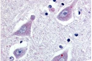 Anti-GPR30 antibody  ABIN1048794 IHC staining of human brain, hippocampus. (GPER antibody  (Extracellular Domain))