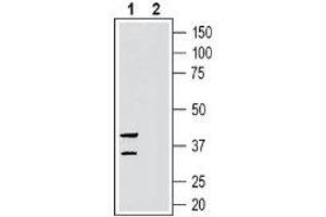 GPR35 antibody  (Extracellular, Loop 2)