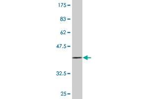 Western Blot detection against Immunogen (36. (BMPR2 antibody  (AA 939-1037))
