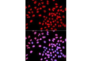 Immunofluorescence analysis of U2OS cell using IKZF1 antibody. (IKZF1 antibody  (AA 1-270))