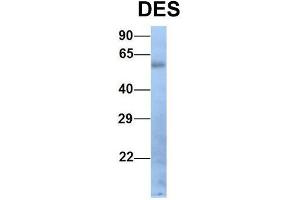 Host:  Rabbit  Target Name:  DES  Sample Type:  Human Fetal Lung  Antibody Dilution:  1. (Desmin antibody  (Middle Region))